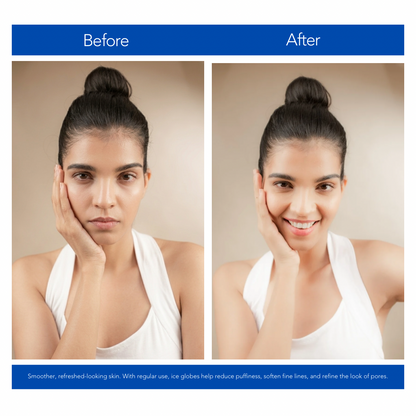 Ice Globes: The 5-Minute Cryo-Facial for Instant Depuffing